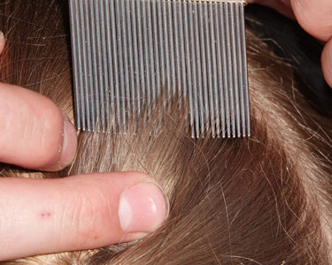 Kids Sarasota and Bradenton: Lice Treatment - Fun 4 Manasota Kids